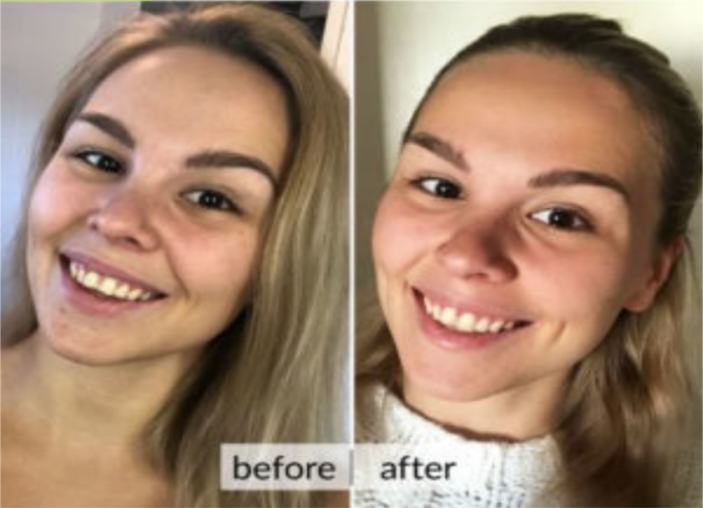 fitline skin maschera viso risultati