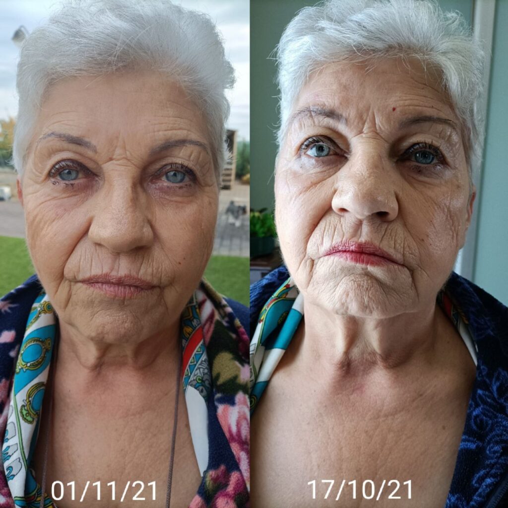Beauty FitLine prima e dopo