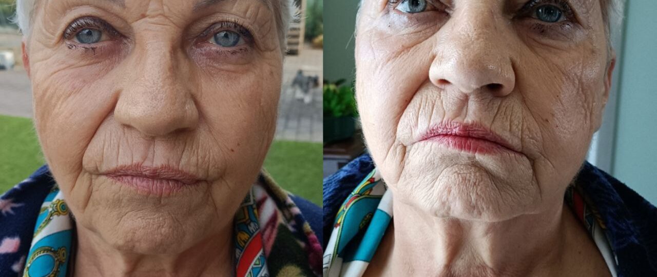 Beauty FitLine prima e dopo