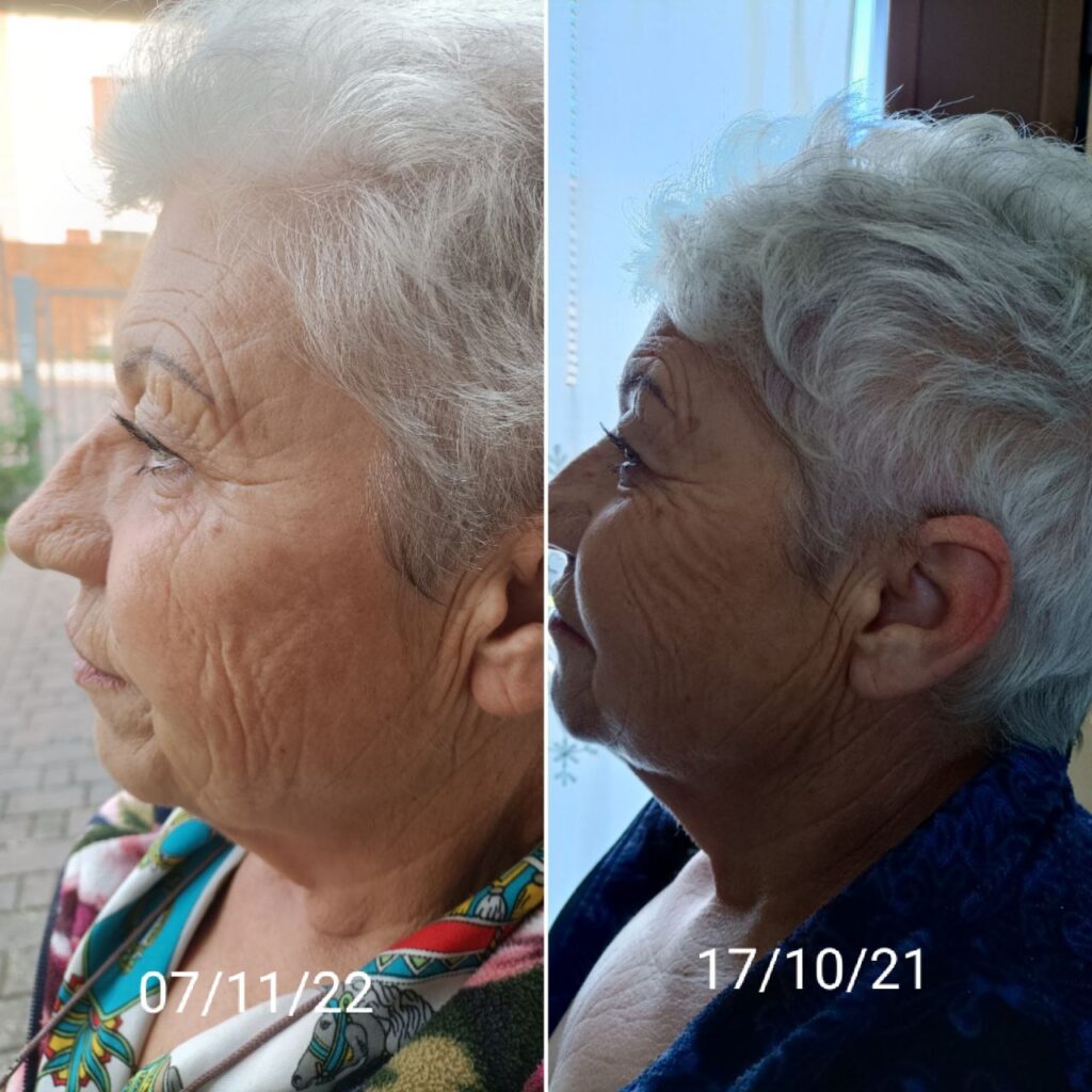 Beauty FitLine prima e dopo