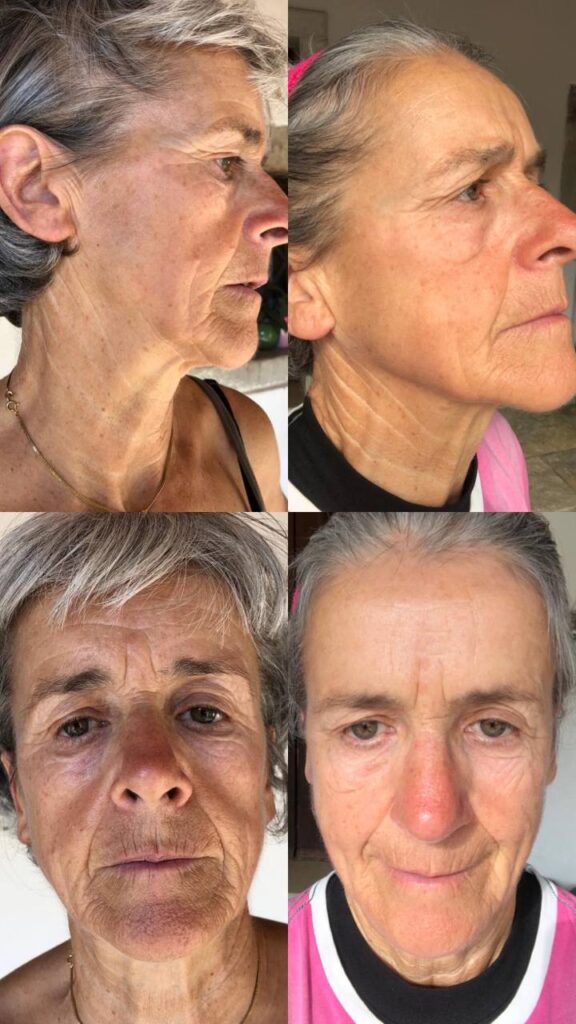 Beauty FitLine prima e dopo