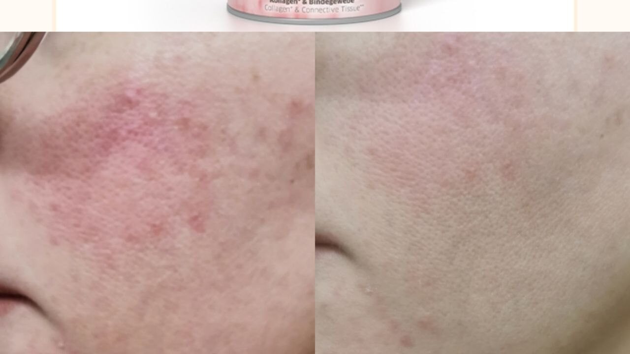 Beauty FitLine prima e dopo